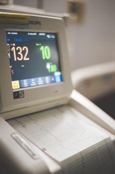 Close-up view of an ECG monitor displaying patient vitals and printed graphs.